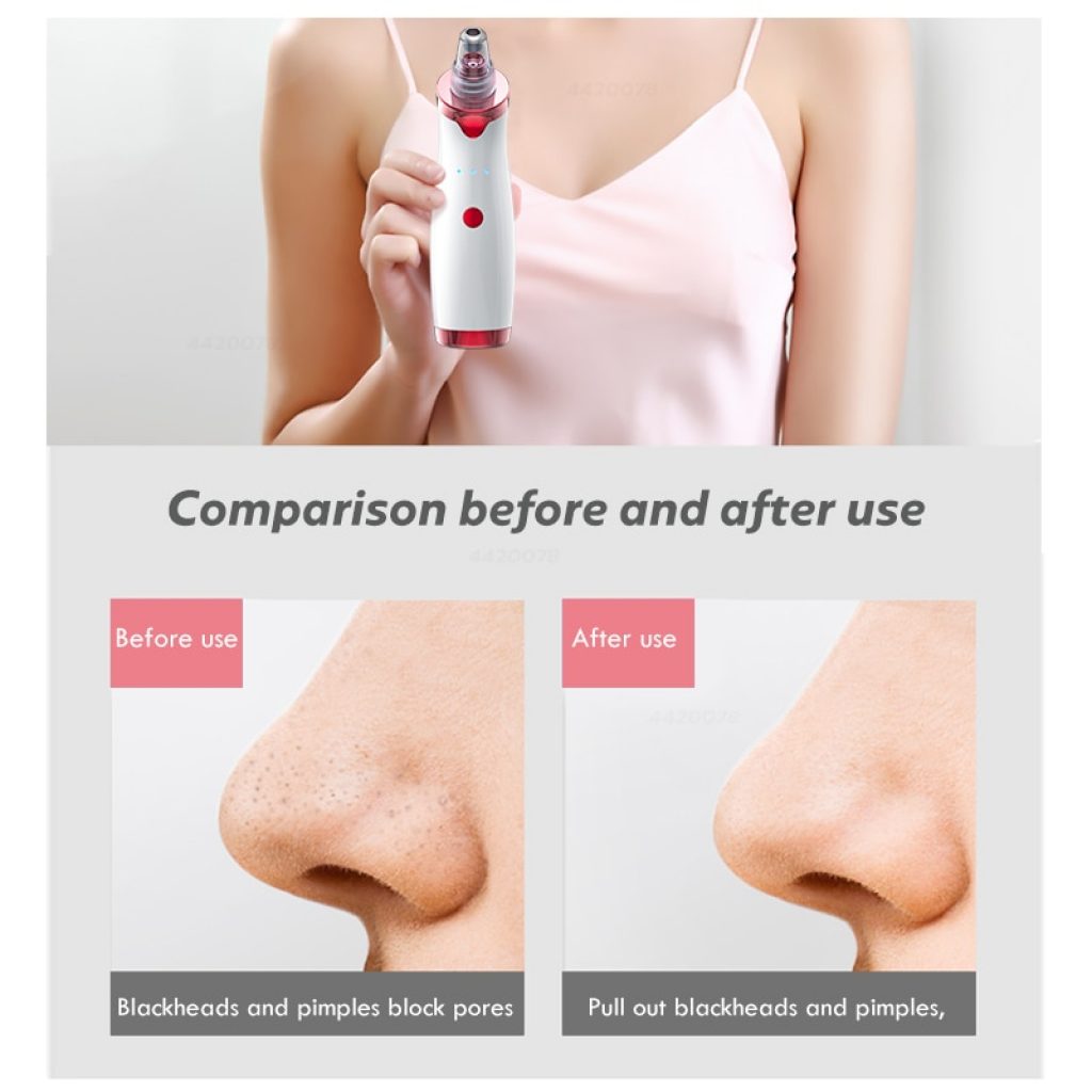 Blackhead Remover Face Deep Nose Cleaner T Zone Pore Acne Pimple Removal Vacuum Suction Facial Diamond 2