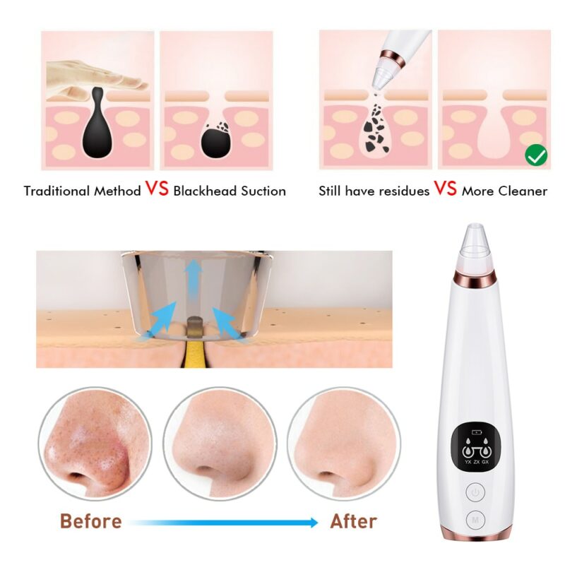 Blackhead Remover Vacuum Pore Cleaner Electric Nose Face Deep Cleansing Skin Care Machine Birthday Gift Dropshipping 1