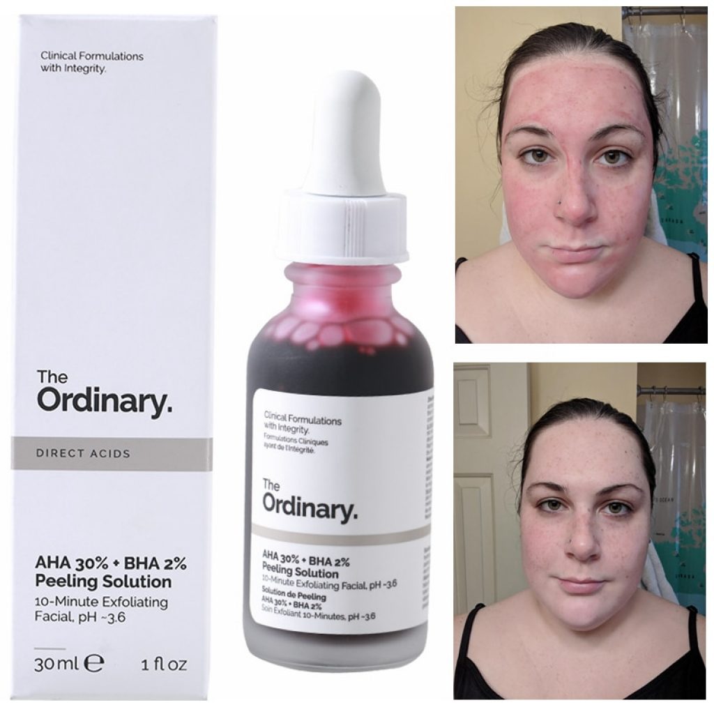 The Ordinary Peeling Solution 30ml AHA 30 BHA 2 to peel that dead top layer so