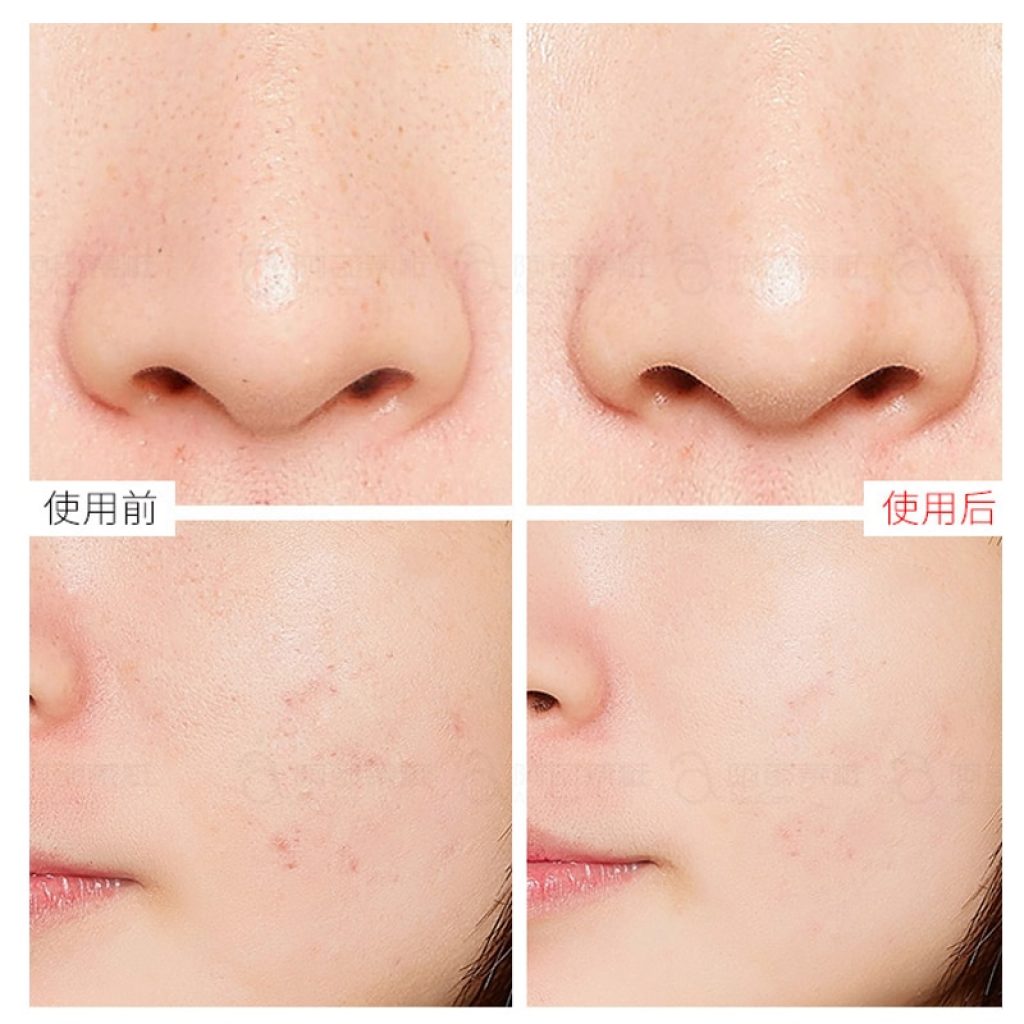 Primer Makeup The Ordinary AHA 30 BHA 2 Peeling Solution Exfoliating Anti Aging Acne Removing Serum 1