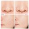 The Ordinary AHA 30% BHA 2% Peeling Solution Primer Makeup 10-Minute Exfoliating Face Brighten Anti Aging Serum Face Skin Care